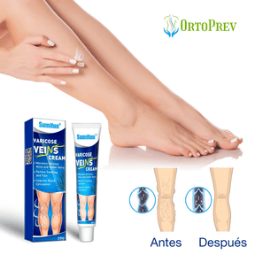 Crema para Eliminar Varices [Resultados Comprobados]