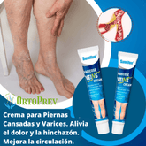 Crema para Eliminar Varices [Resultados Comprobados]