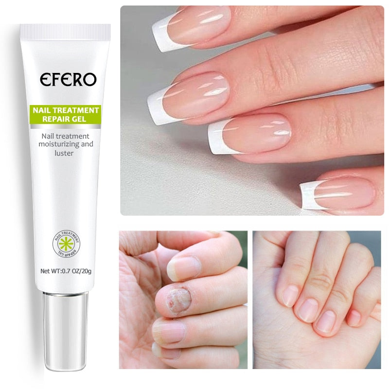 ephero | Anti-Inflammatory Fungus Elimination Cream + Gifts [PROVEN RESULT]