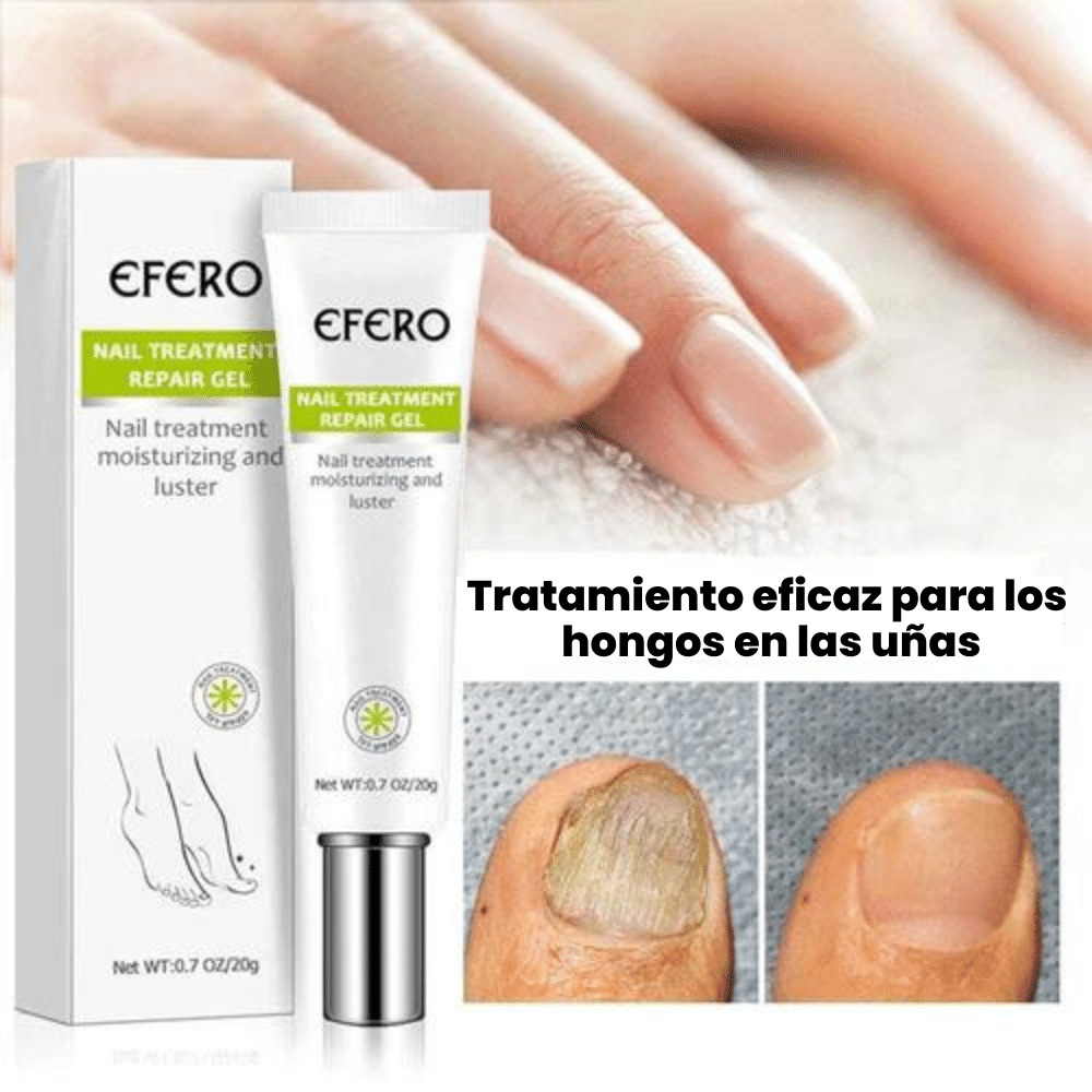 ephero | Anti-Inflammatory Fungus Elimination Cream + Gifts [PROVEN RESULT]